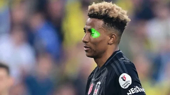 Fenerbahçe-Beşiktaş Derbisinde Gedson’a Lazer Tutan Taraftar Gözaltında!