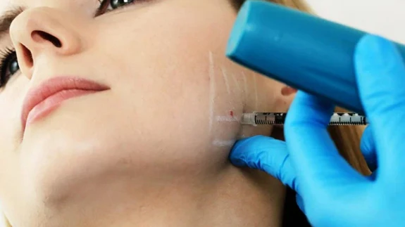 Diş Sıkmaktan Kurtulmanın En Etkili Yolu: Masseter Botoksu Mucizesi!