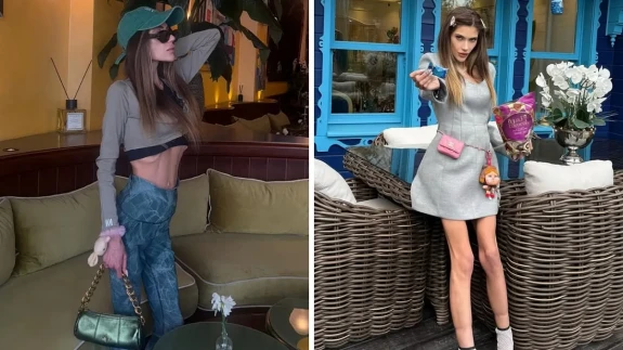 Cezaevinden 37 kilo ile çıktı şimdi yoğun bakımda!