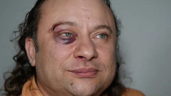 “Bayıldı, kalp kriziymiş!” Ünlü ses sanatçısından korkutan haber