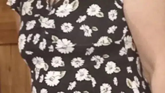 Boşanmış çiftin draması: Ankara’da silahlı saldırı sonrası kendini vurdu!