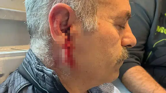 Çıkış işlemi için gitti, hastanelik oldu... İstanbul’da özel kurumda şiddet iddiası!