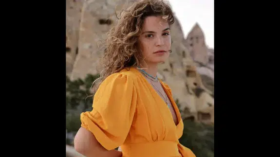 Yanlış Ameliyat Hayatını Kabusa Çevirdi! Ünlü Oyuncu Aslı Bekiroğlu'ndan Şok İtiraf