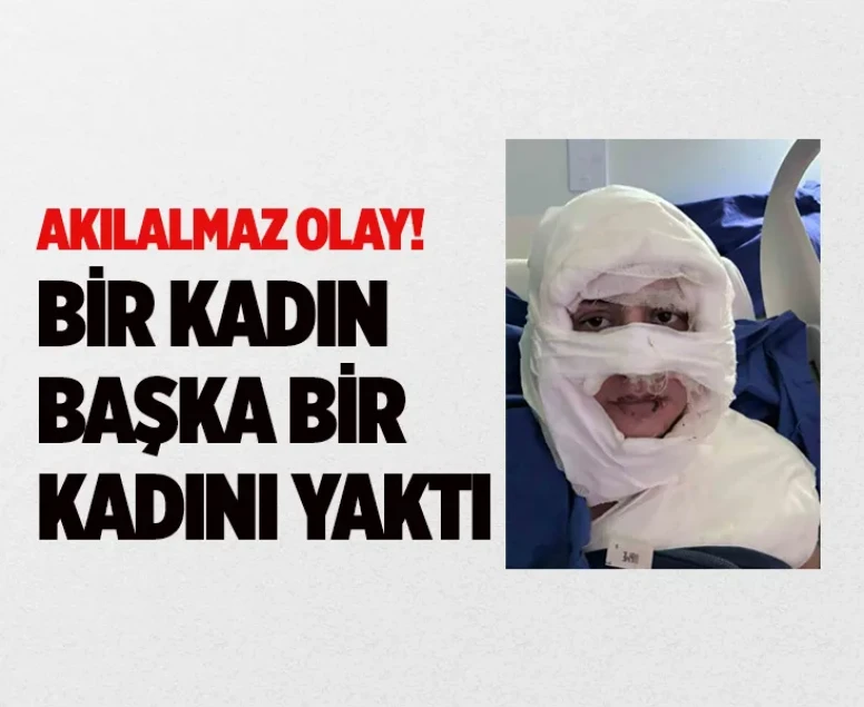 Kadıköy’de akıl almaz olay: Genç kadın başka bir kadın tarafından ateşe verildi