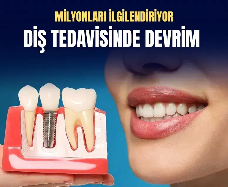 Diş tedavisinde yeni dönem: İmplant masraflarını SSK karşılayacak! İşte şartları