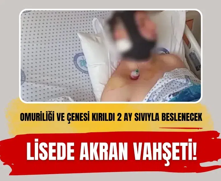 Eskişehir’de öğrenciler arasında kavga! Omuriliği ve çenesi kırıldı, 2 ay sıvıyla beslenecek