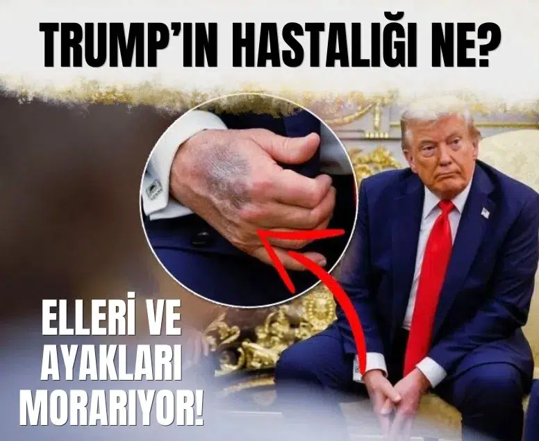 ABD Başkanı Trump 80 yaşına basmadan önce sağlık kontrolünden geçti