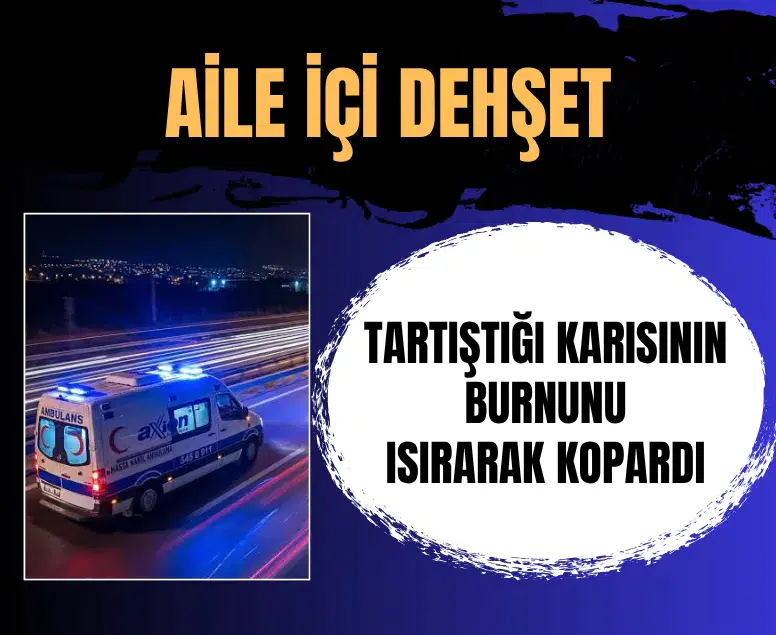 Manisa'da aile içi dehşet: Karısının burnunu ısırarak kopardı
