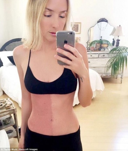 İkizini senelerce vücudunda taşıdı! 3