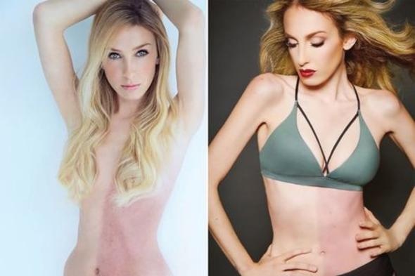 İkizini senelerce vücudunda taşıdı! 14