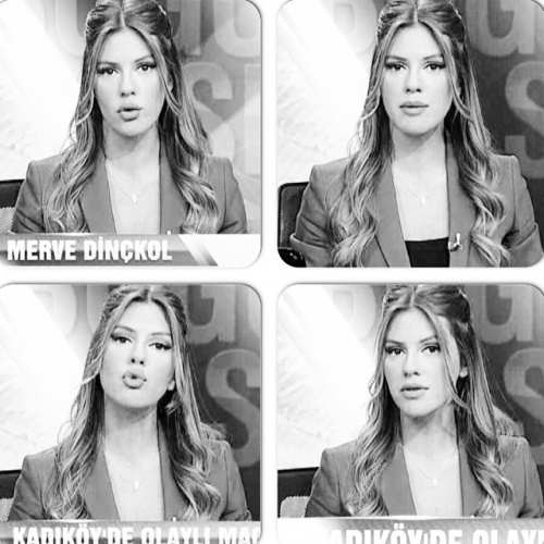 Merve Dinçkol fotoğrafları, estetiksiz hali 85