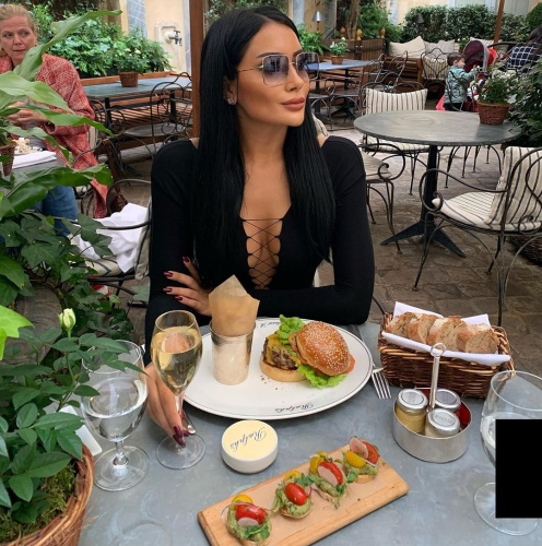 İşte Benim Stilim'de ünlenen Niran Yalaz'ın estetikle gelen müthiş değişimi! 19