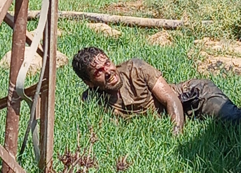 Polis ve sağlıkçılar alarma geçti: Kuduz hastası hastaneden kaçtı