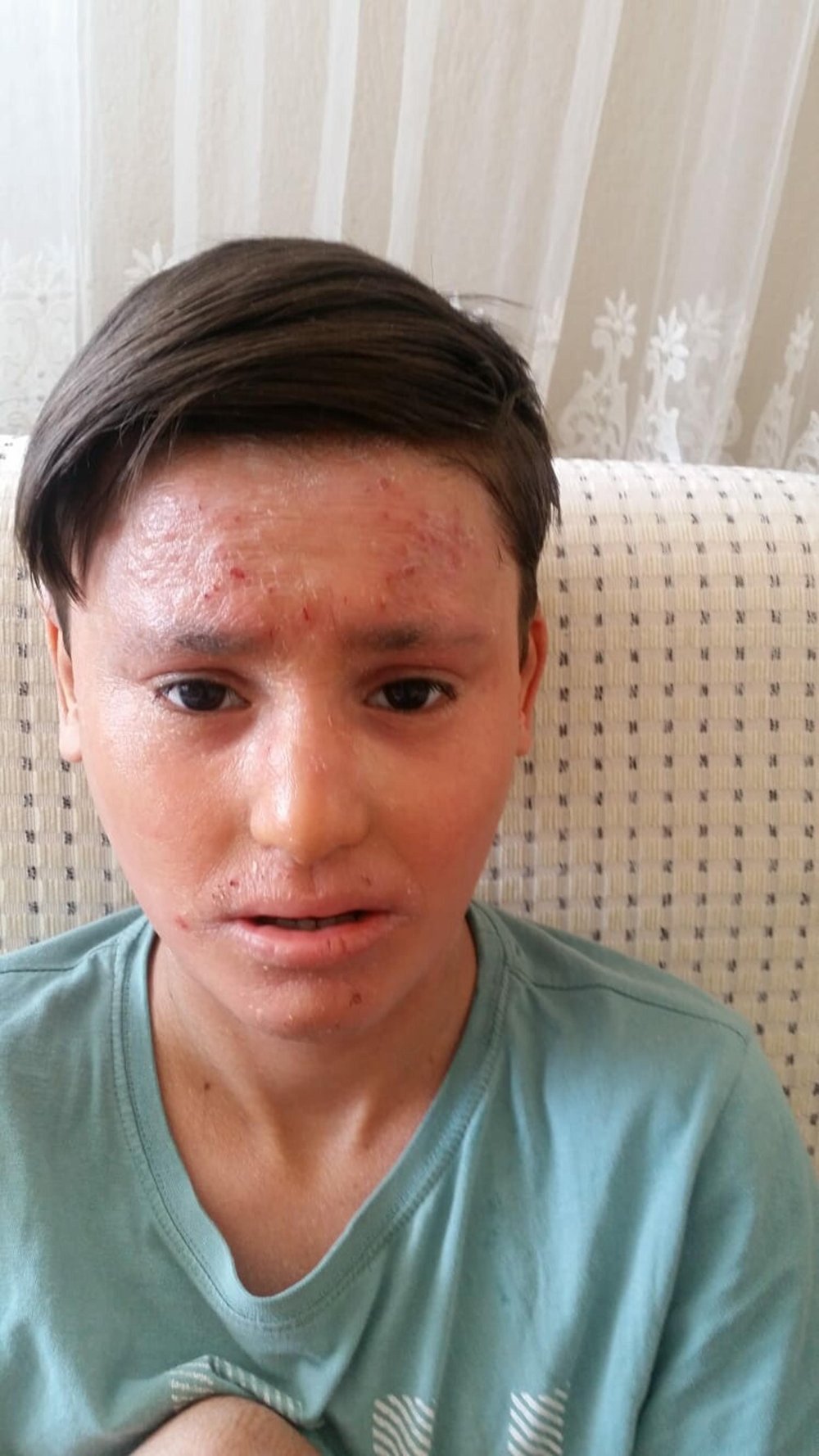 Gündüzleri evden çıkamıyor: 'İlaçları kullanmadan uyuyamıyorum'