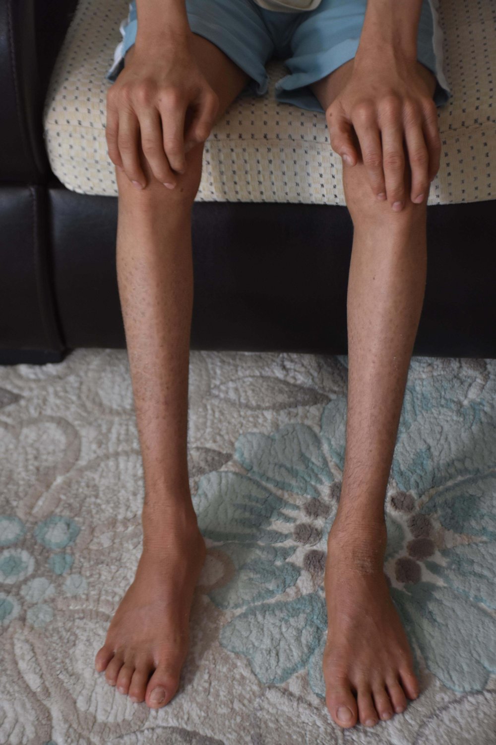 Gündüzleri evden çıkamıyor: 'İlaçları kullanmadan uyuyamıyorum'