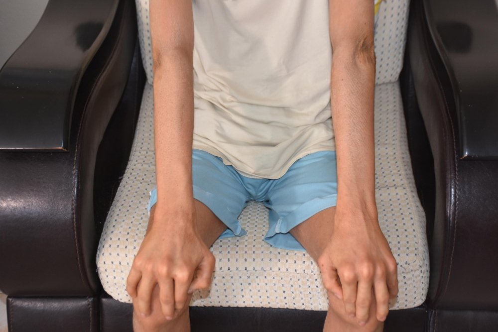 Gündüzleri evden çıkamıyor: 'İlaçları kullanmadan uyuyamıyorum'