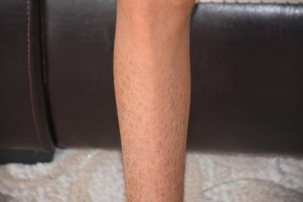 Gündüzleri evden çıkamıyor: 'İlaçları kullanmadan uyuyamıyorum'