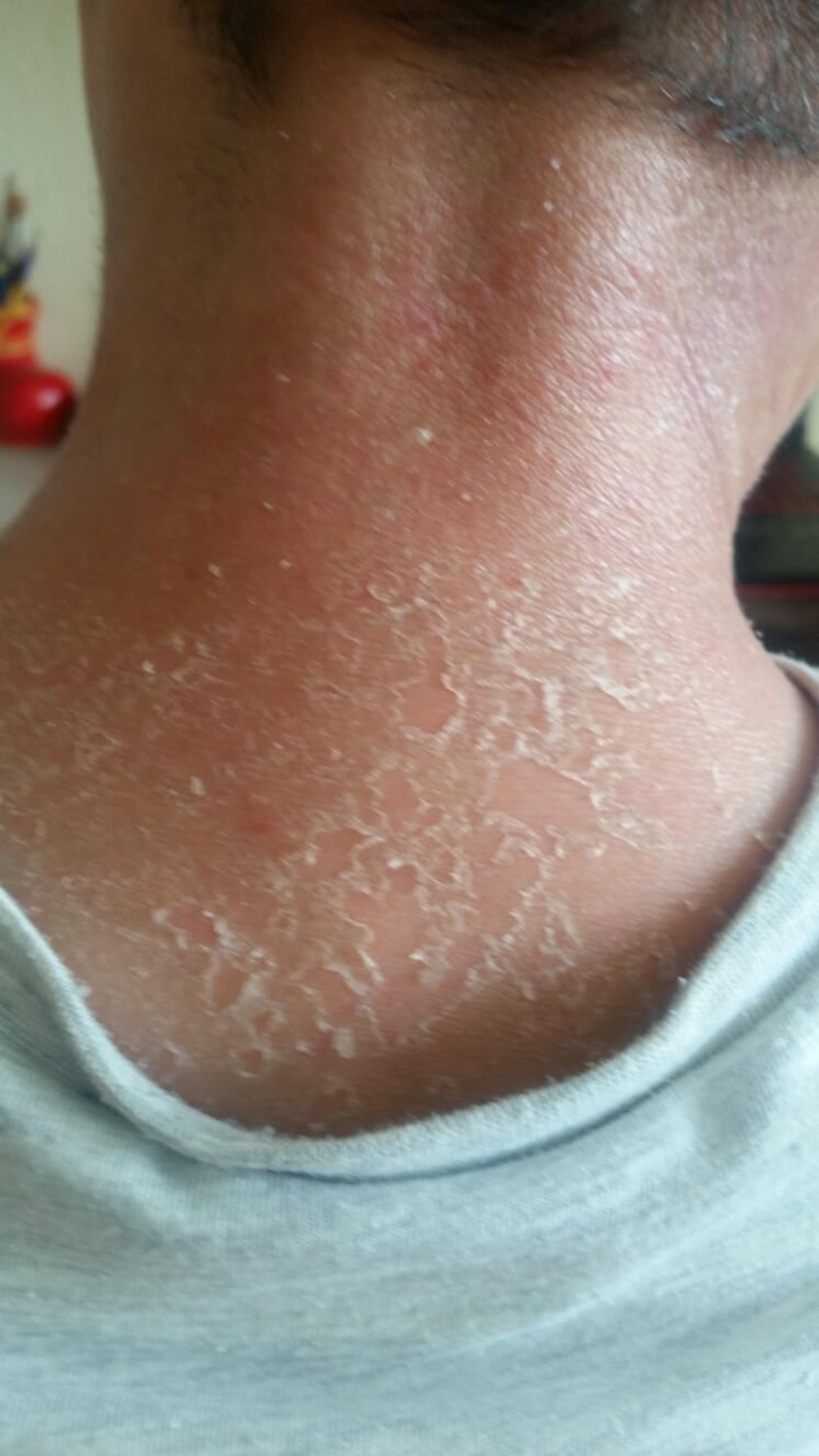 Gündüzleri evden çıkamıyor: 'İlaçları kullanmadan uyuyamıyorum'