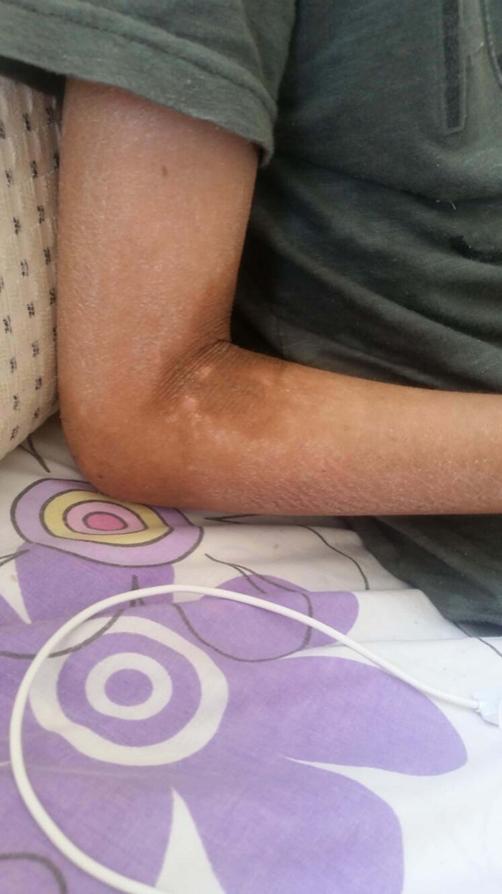 Gündüzleri evden çıkamıyor: 'İlaçları kullanmadan uyuyamıyorum'