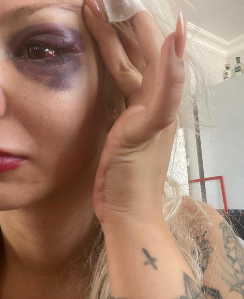 Yüzyüzeyken Konuşuruz gitaristine sevgilisini darbettiği iddiasıyla soruşturma