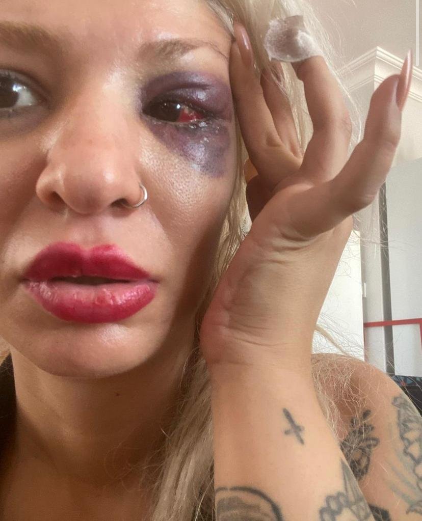 Yüzyüzeyken Konuşuruz gitaristine sevgilisini darbettiği iddiasıyla soruşturma