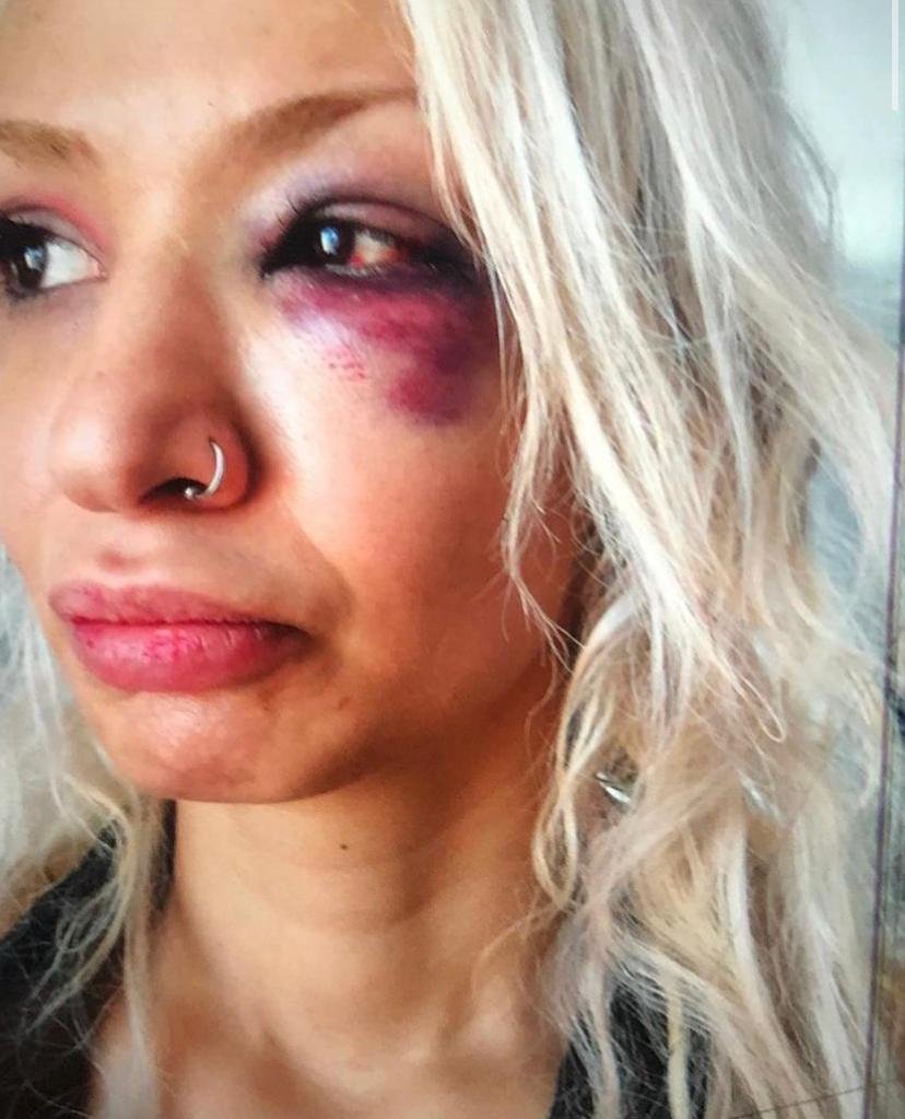 Yüzyüzeyken Konuşuruz gitaristine sevgilisini darbettiği iddiasıyla soruşturma