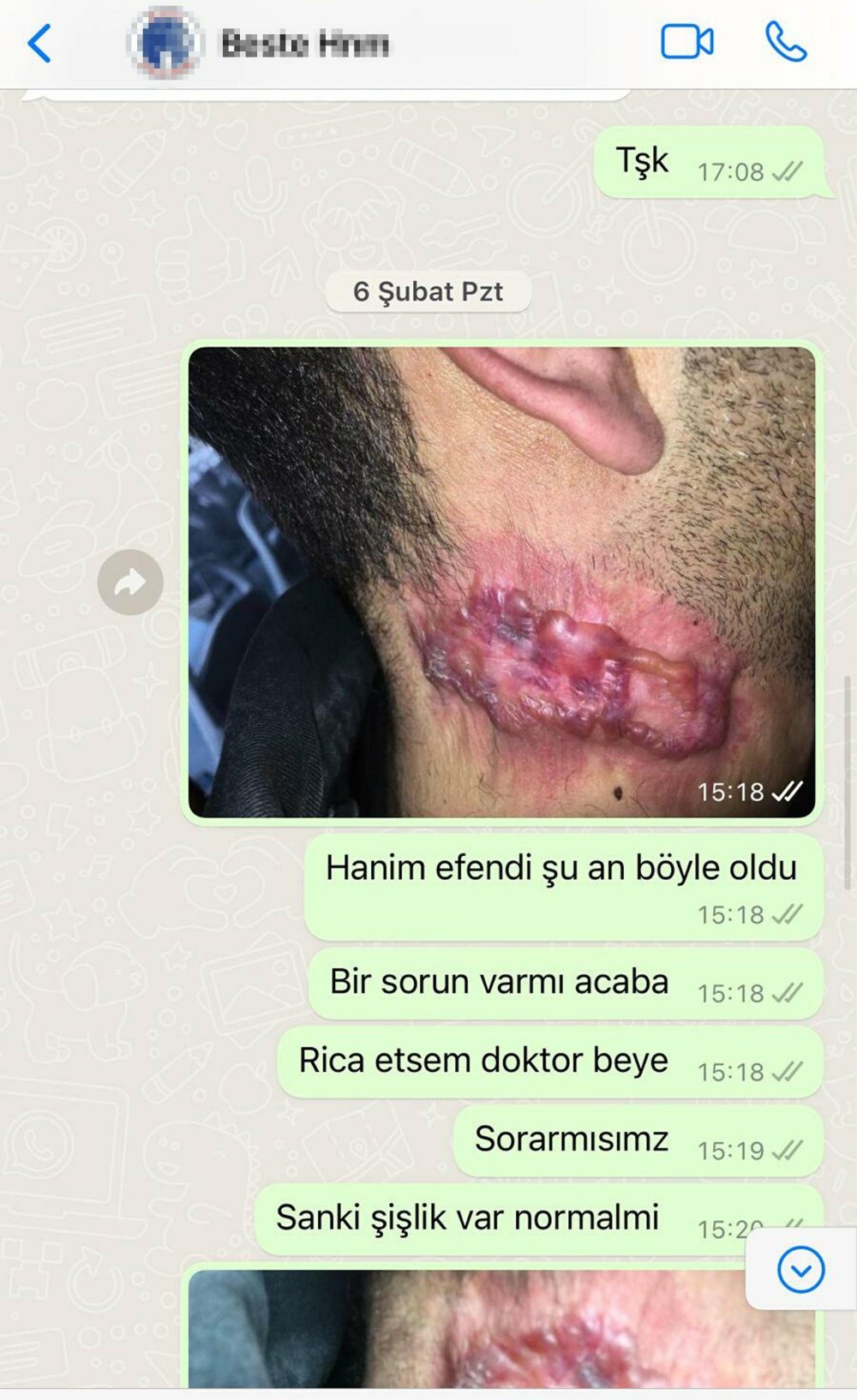 Lazer tedavisi sonrası hayatı kabusa döndü
