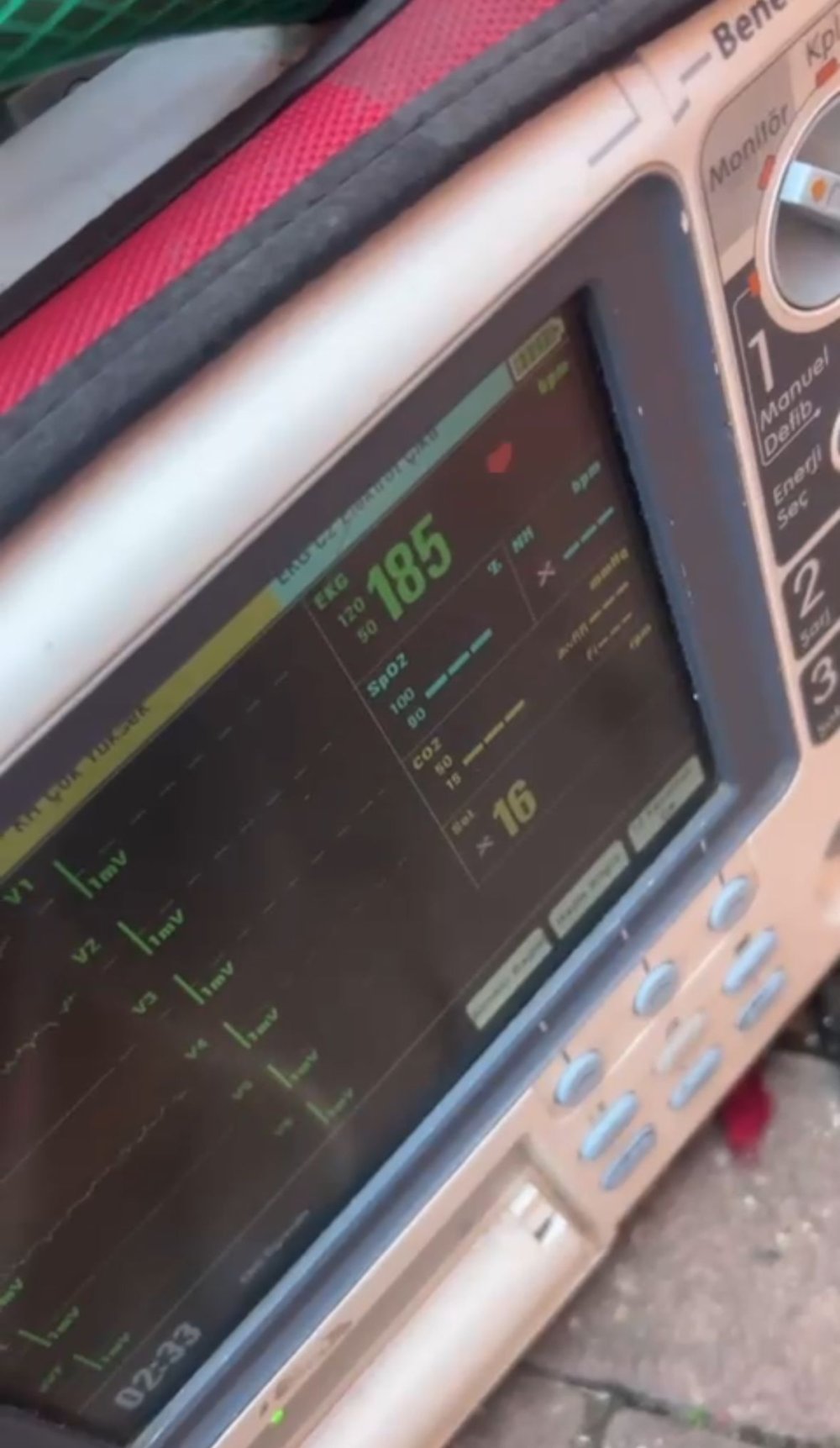 Tabutta nabzı atan 80 yaşındaki adamın EKG görüntüleri ortaya çıktı