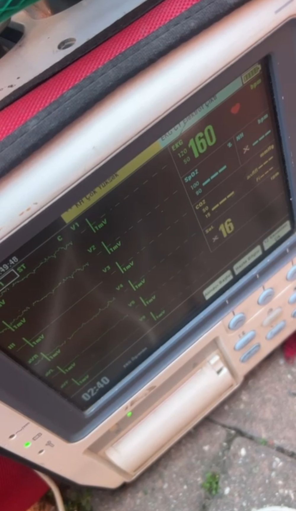 Tabutta nabzı atan 80 yaşındaki adamın EKG görüntüleri ortaya çıktı