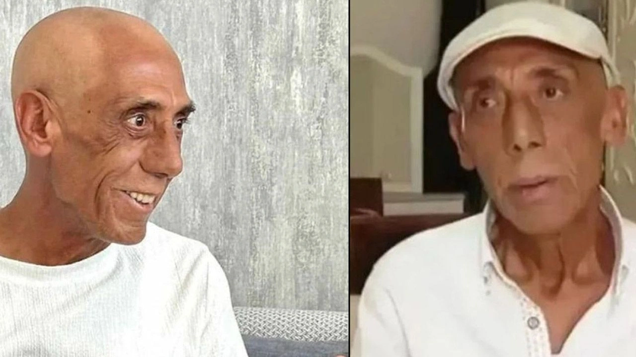 Kanserle savaşan Ankaralı Turgut'tan kötü haberi kızı paylaştı 5