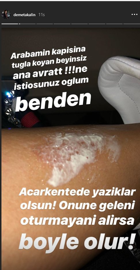 demet akalın instagram