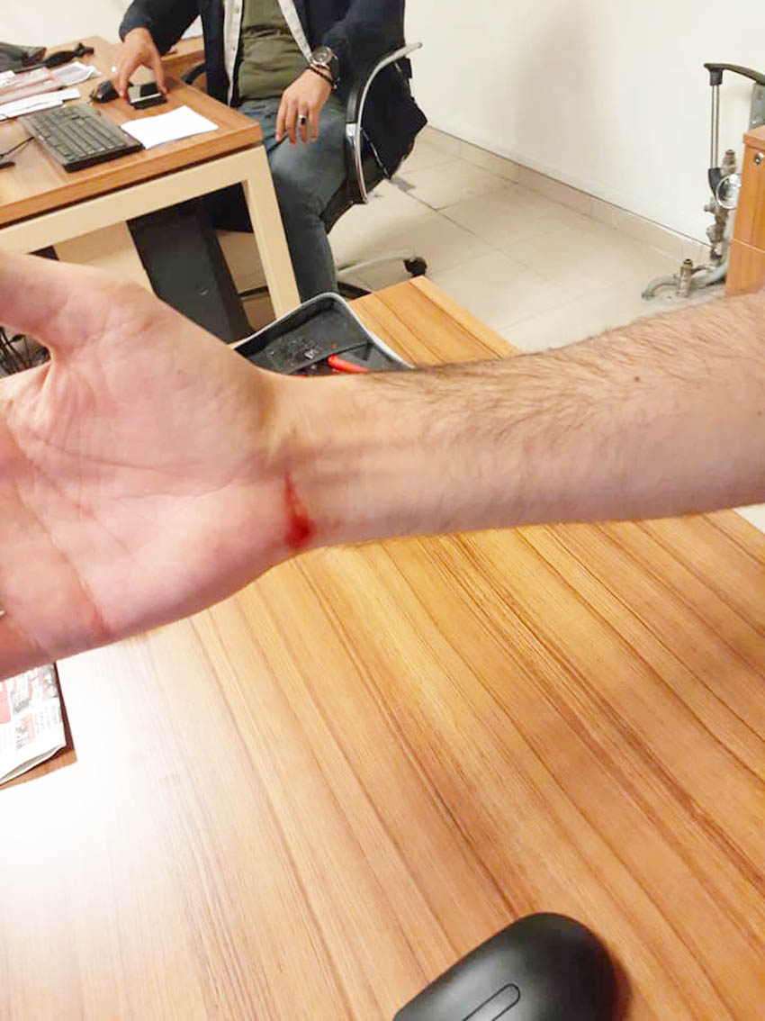 ataşehir belediyesi disk gökhan keskin dayak kavga darp