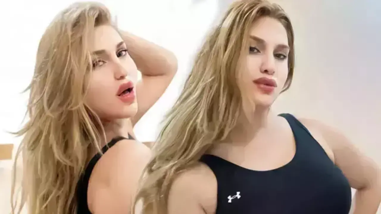 Survivor Almeda Baylan Sakatlandı mı? Almeda’ya ne oldu? Sağlık durumu nasıl, yarışmaya devam edecek mi? 2