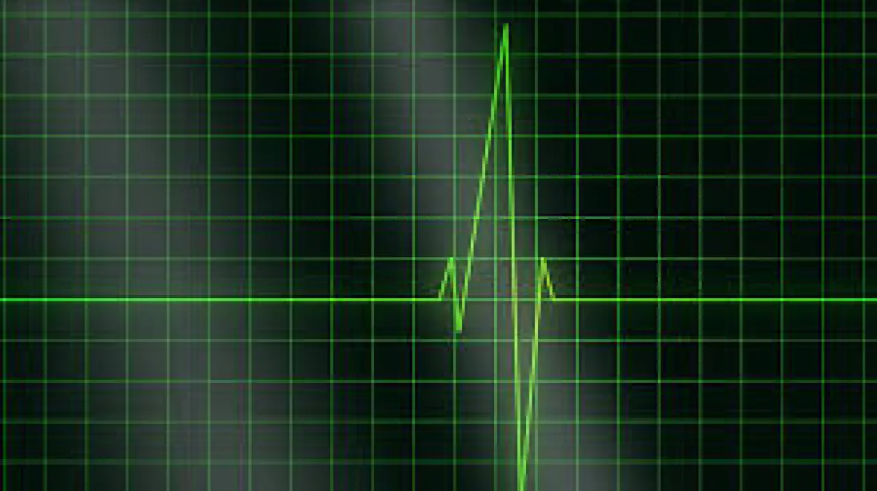 Türkiye Kalp Krizi Oranlarında Avrupa’yı Geride Bıraktı! Rakam Korkutucu 6