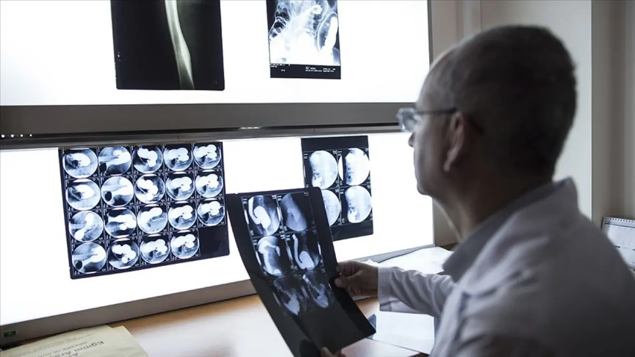 Bilim Dünyası Şokta! Stresin Kanseri Tetiklediği Resmen Kanıtlandı! 2