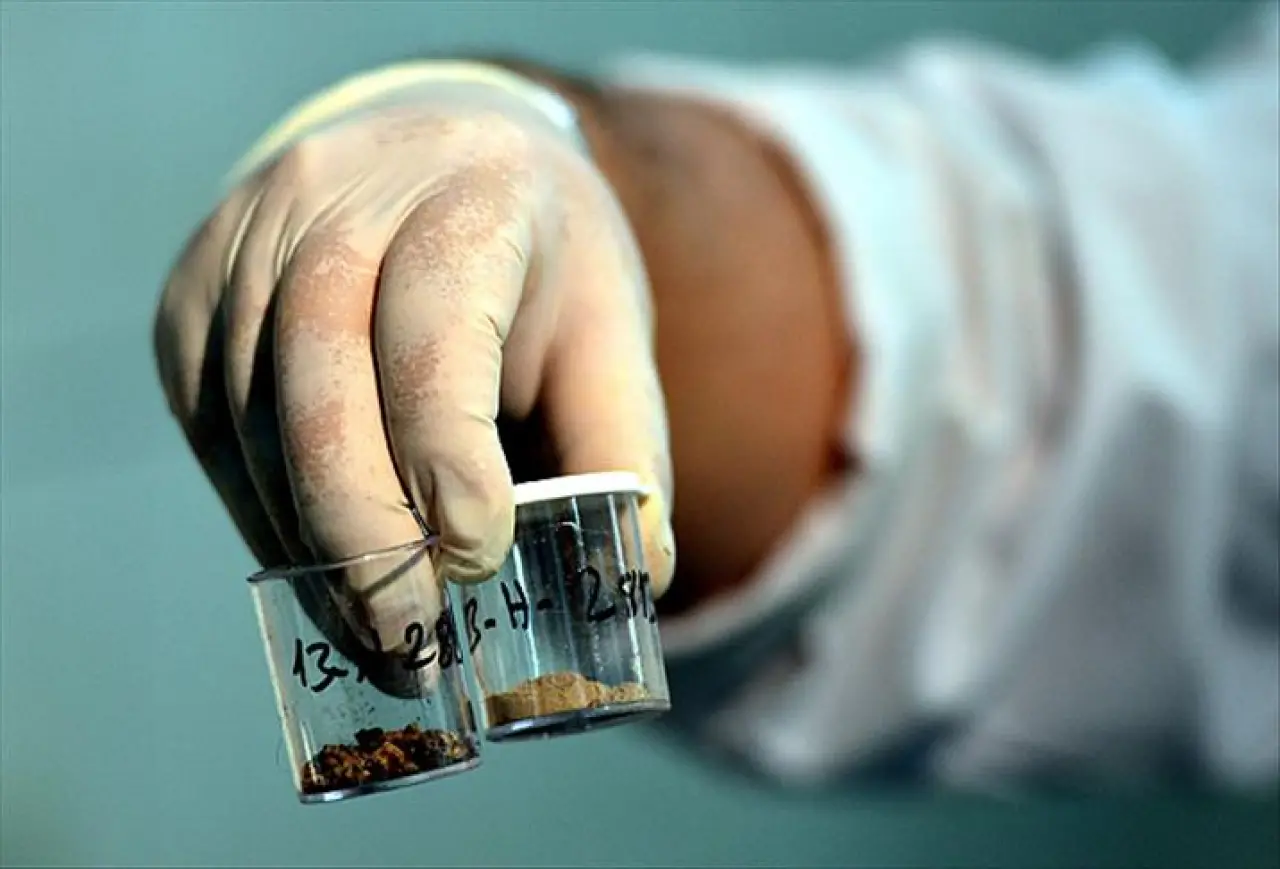 Böbrek Taşı Rahatsızlığı Yaşayanlar Dikkat: Bunlara Çok Dikkat Edilmeli! Böbrek Taşı Belirtileri ve Tedavisi 1