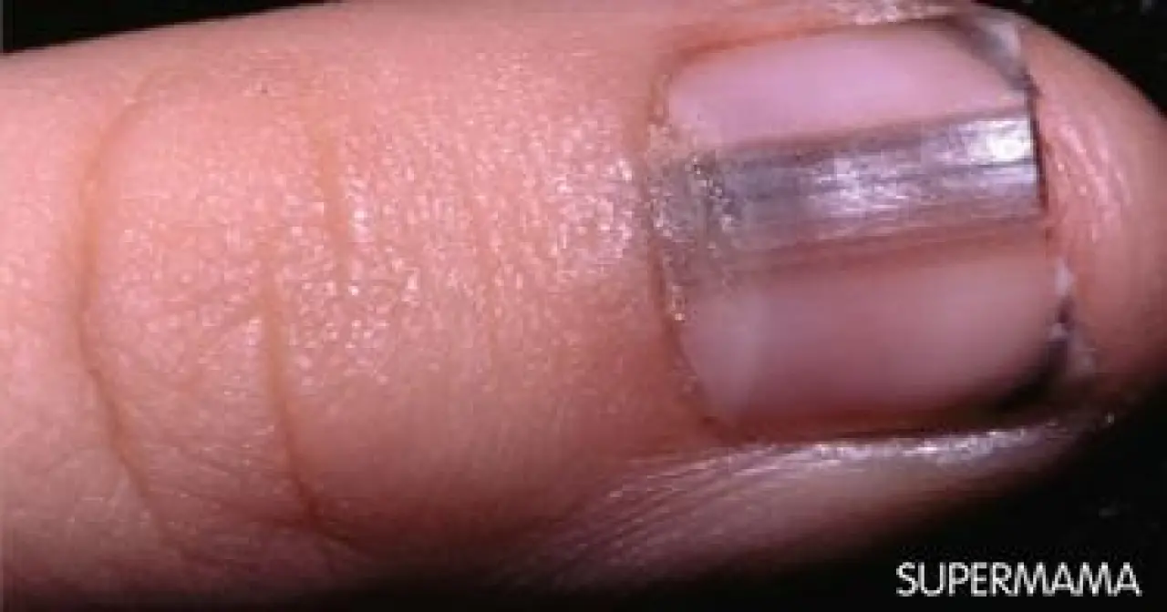 Soluk, Sarı, Mavi... Tırnaklar Ne Söylüyor? 8