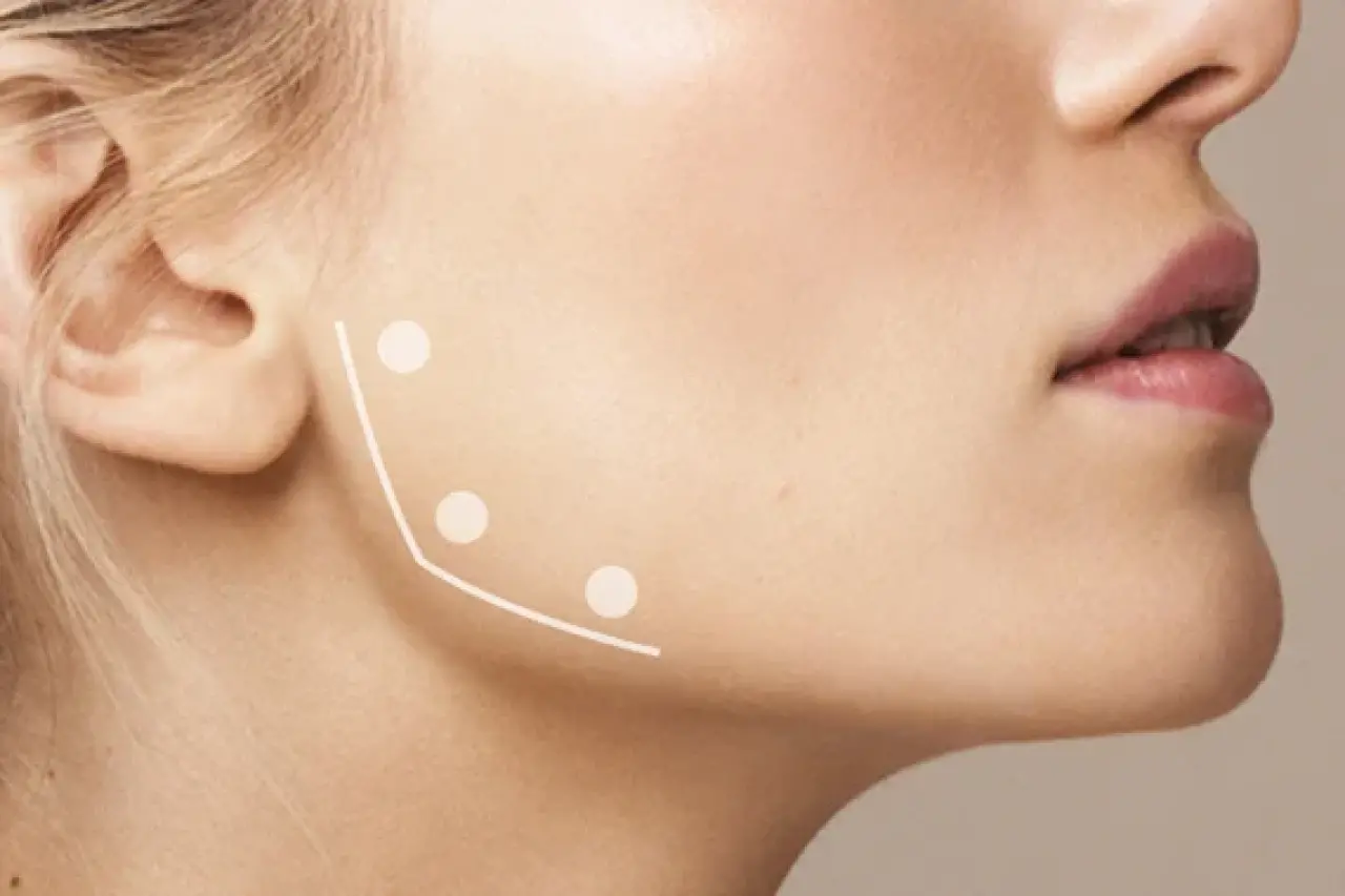 Diş Sıkmaktan Kurtulmanın En Etkili Yolu: Masseter Botoksu Mucizesi! 8