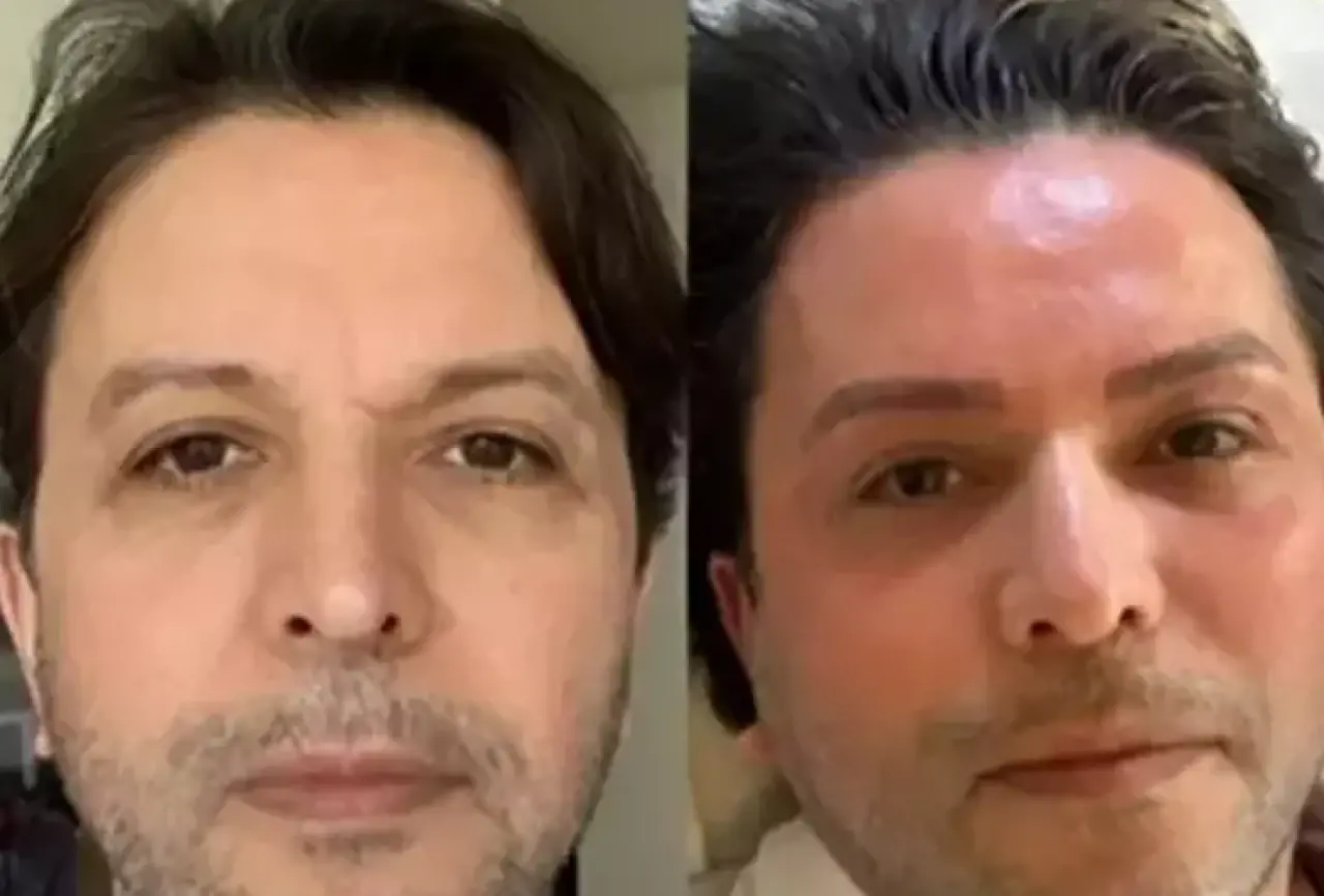 Estetikli Halini Gören Tanıyamadı: Nihat Doğan 10 Yaş Gençleşti! 2