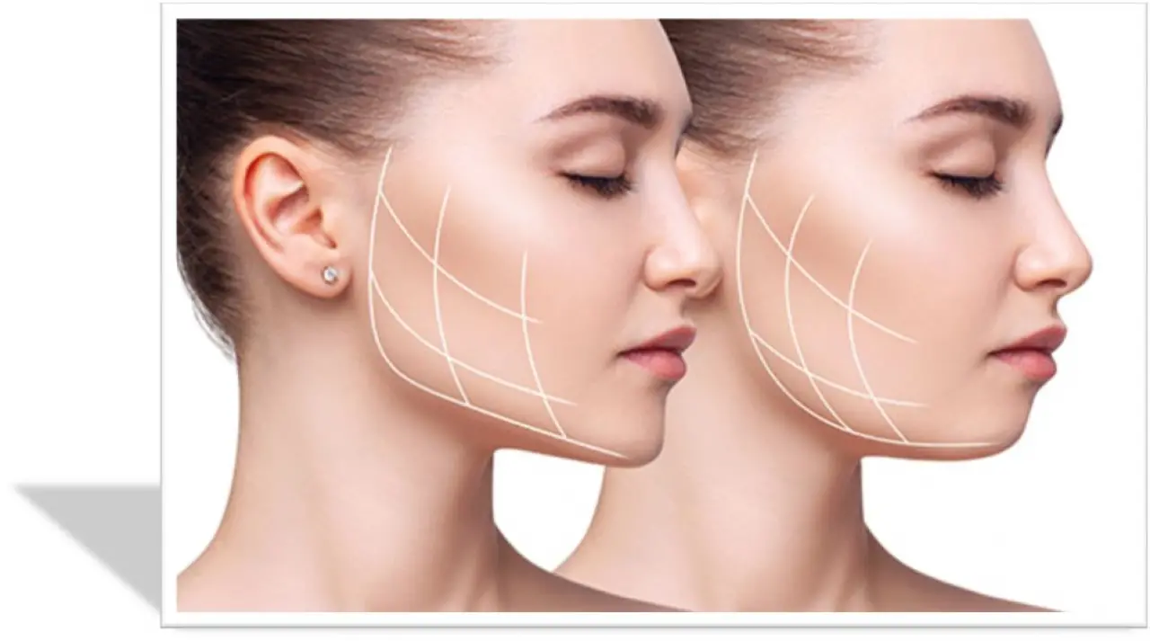 Diş Sıkmaktan Kurtulmanın En Etkili Yolu: Masseter Botoksu Mucizesi! 4