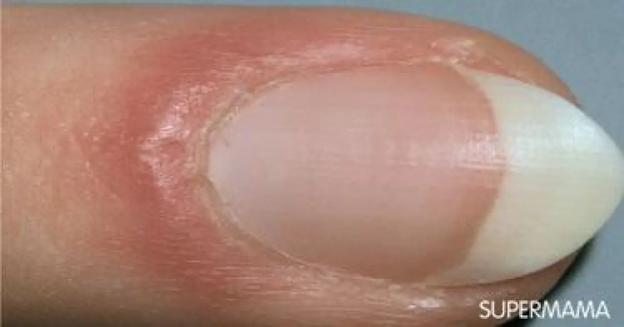 Soluk, Sarı, Mavi... Tırnaklar Ne Söylüyor? 7