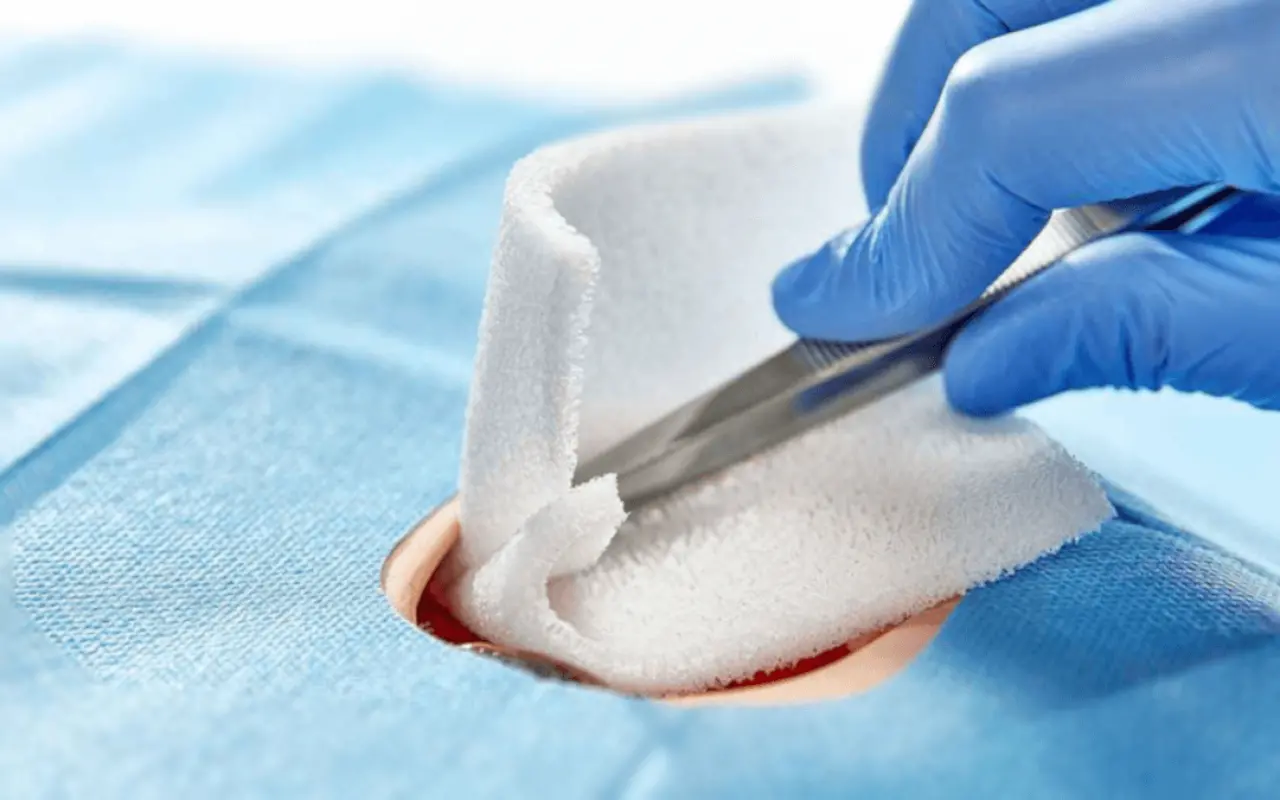 Debridman Nedir, Ameliyatı Nasıl Olur, Tedavi Yöntemleri Nelerdir? 3