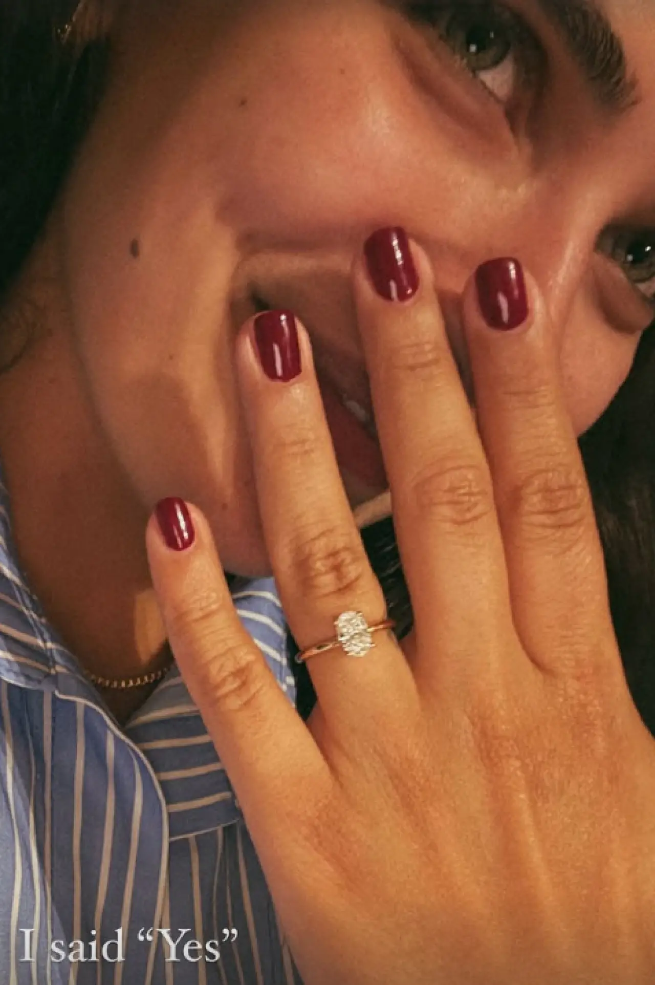 Biran Damla Yılmaz evlilik teklifini kabul etti: “Evet” dediği kişi kim? 2