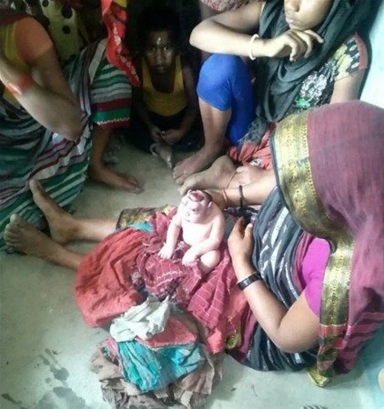 Dünyanın en tuhaf hastalıkları 19