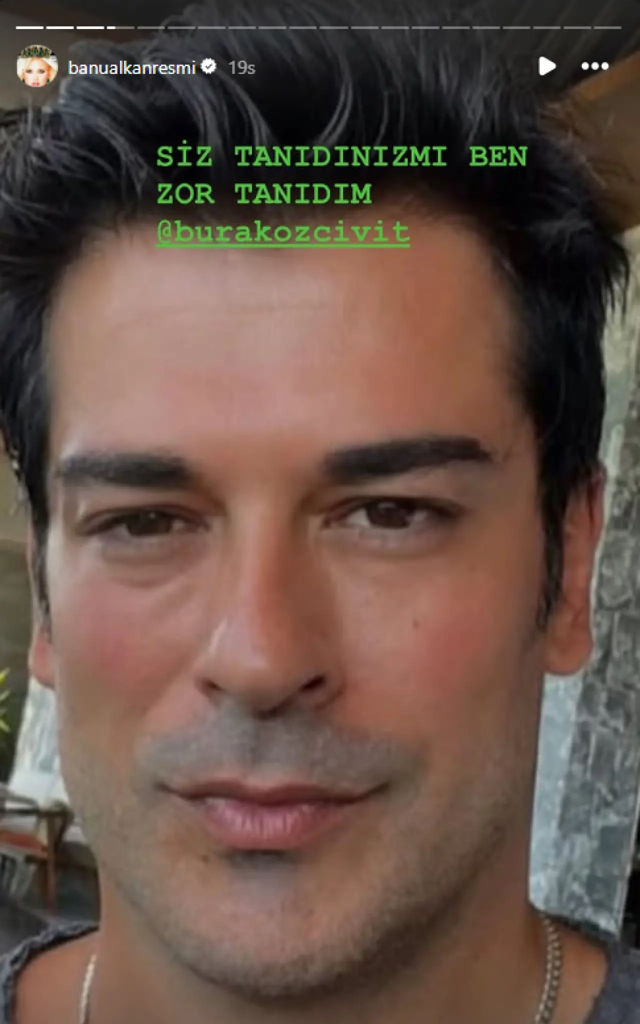 Burak Özçivit’in “Bu kim?” dedirten imaj değişikliği! Banu Alkan bile tanıyamadı 3