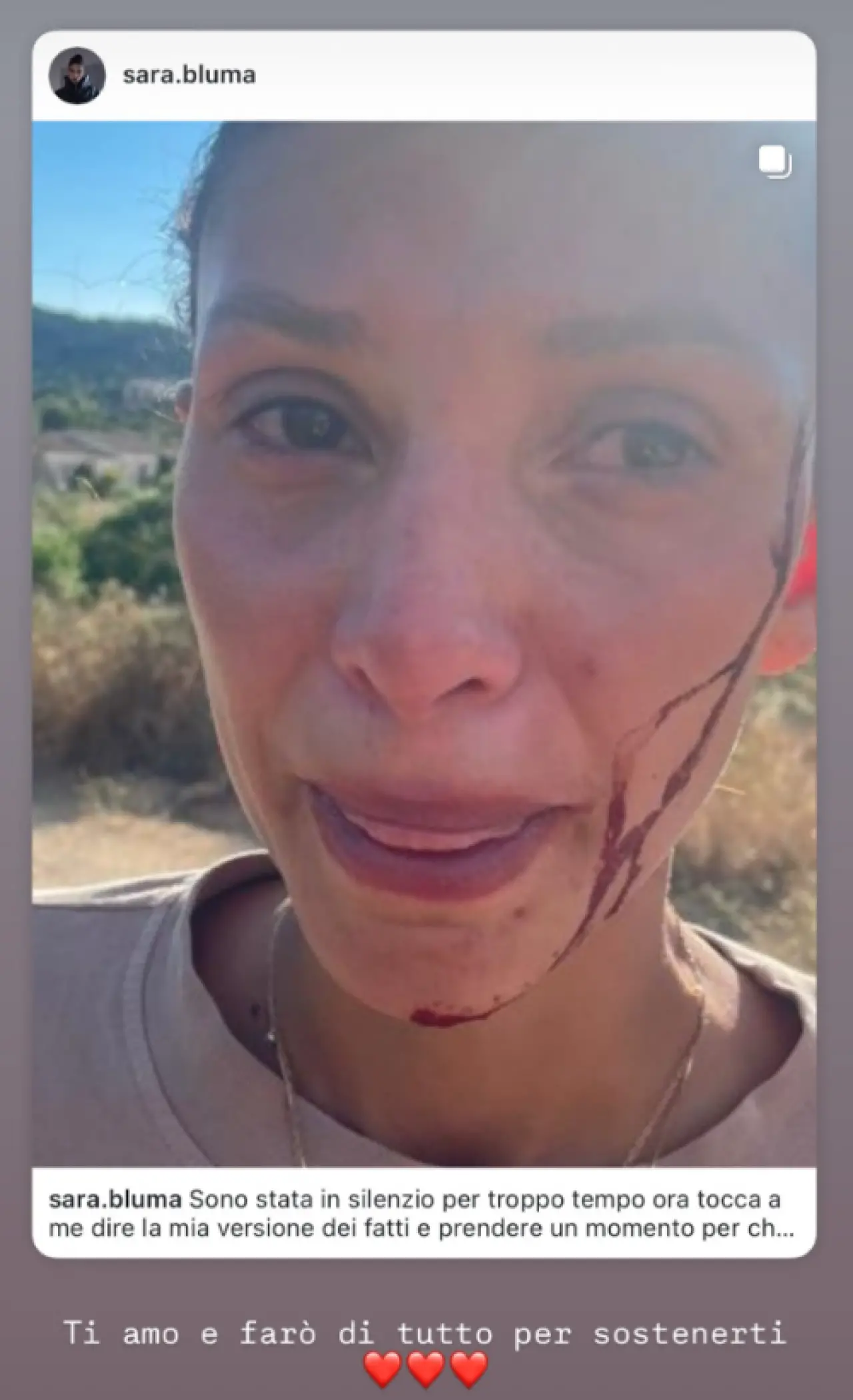 Can Yaman’ın sevgilisi Sara Bluma’dan şok itiraf: “Şiddet gördüm, hiç evlenmedim” 3