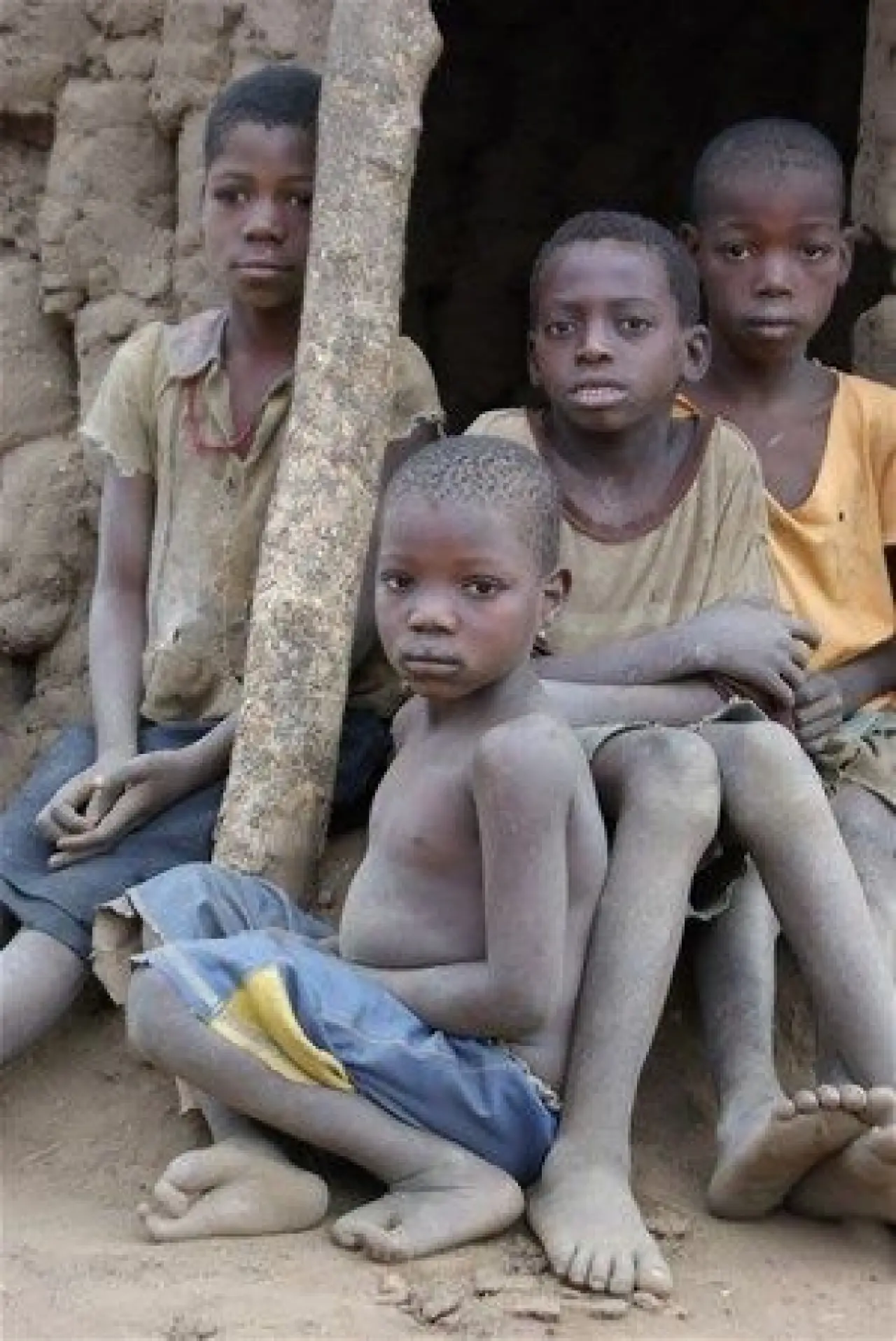 Dünyanın en tuhaf hastalıkları 14