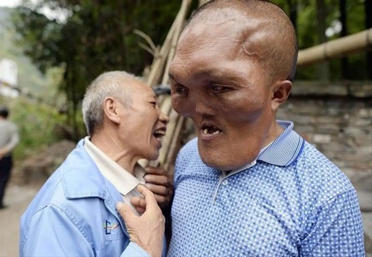 Dünyanın en tuhaf hastalıkları 3