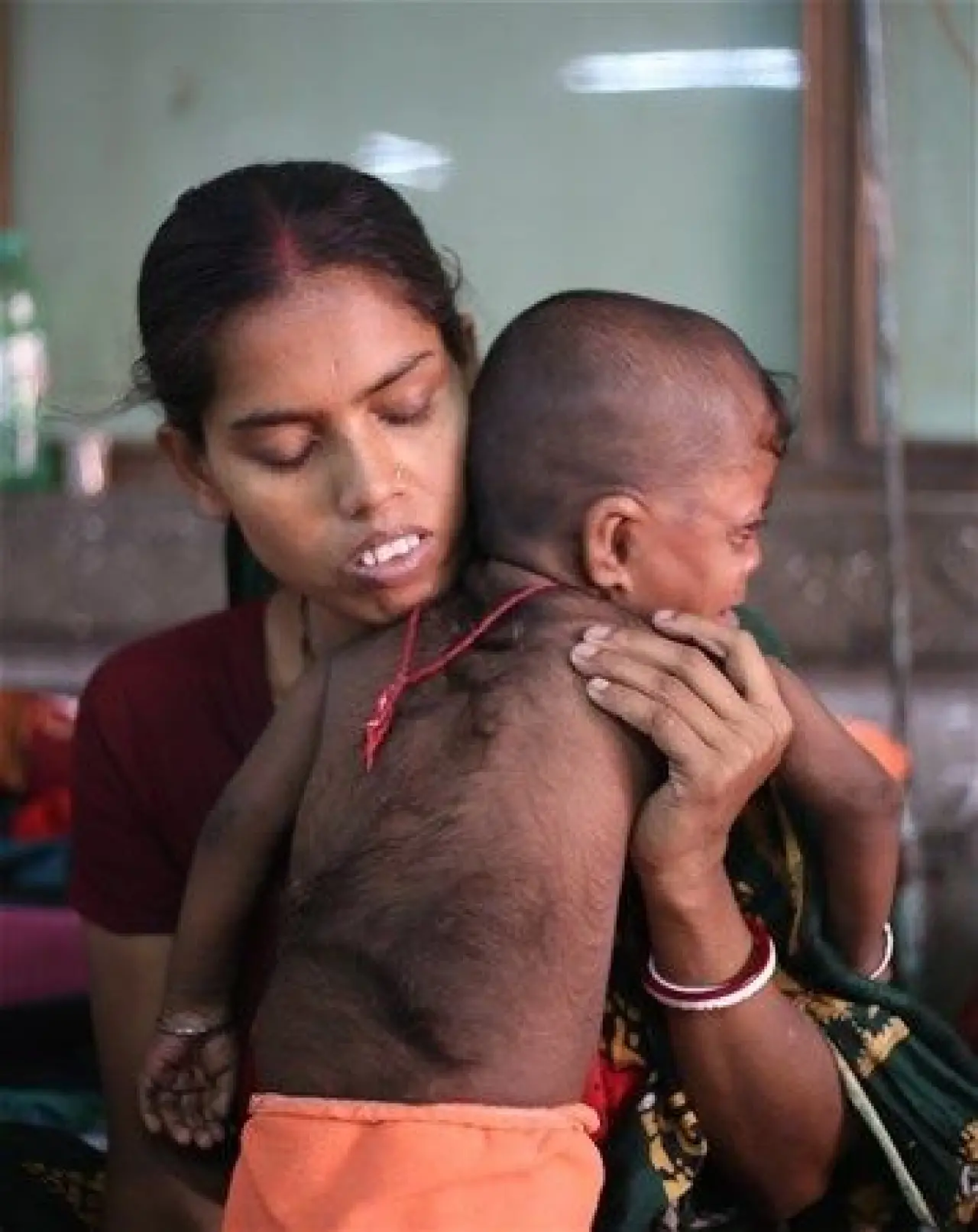 Dünyanın en tuhaf hastalıkları 10