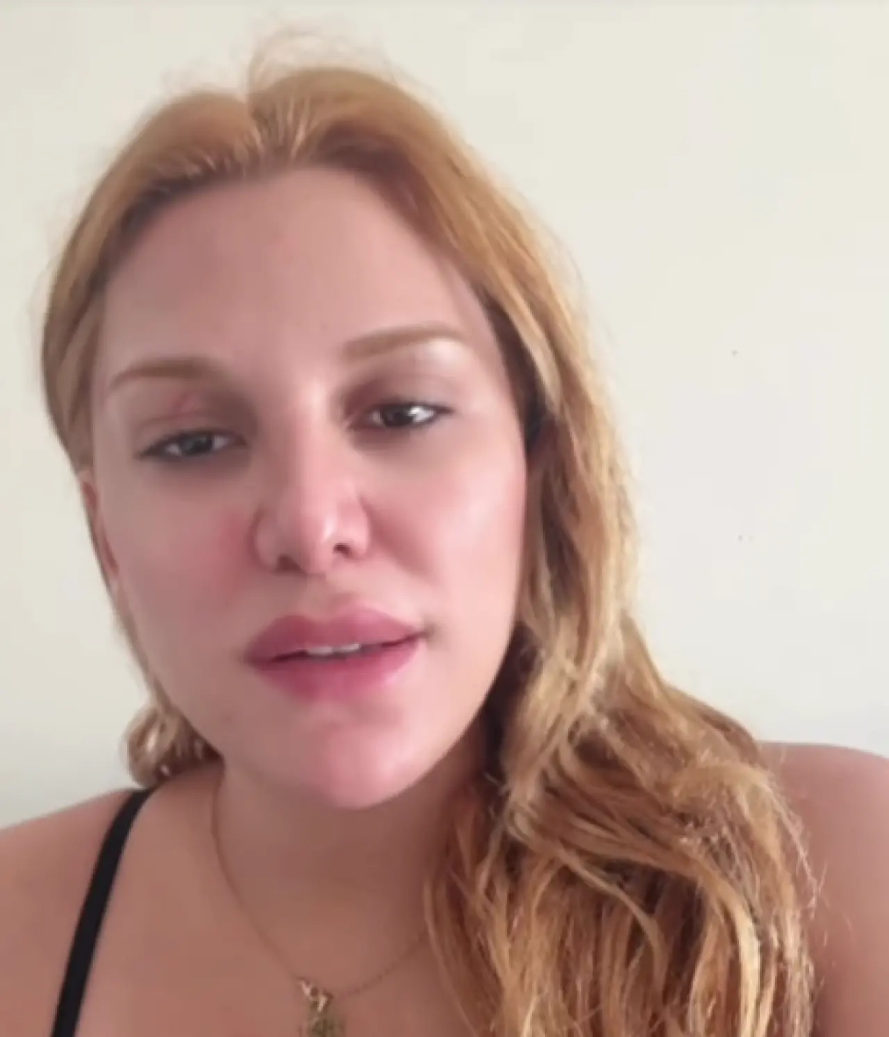 Kemer hayatını kurtardı! Almeda’nın uçurumdan dönüşü film gibi 1